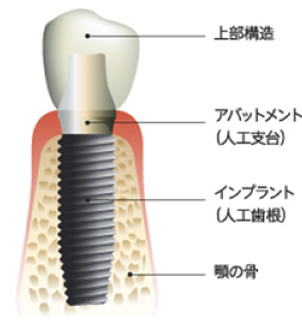 ����ץ��ȿ޲�