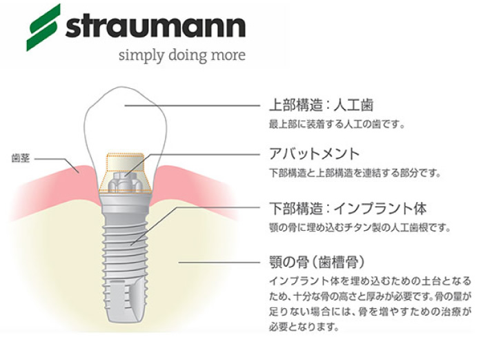 ����ץ���